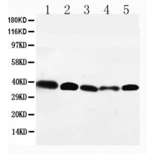 GPR2/CCR10 Antibody