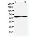 G-protein coupled receptor 30 Antibody