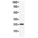 GRB2 Antibody