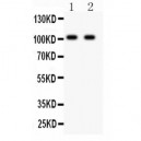 GRIA3  Antibody