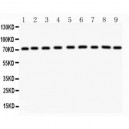 Growth hormone receptor Antibody