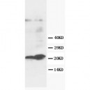 GST3/GST pi Antibody