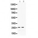 GSTA1/A2/A3/A4/A5  Antibody