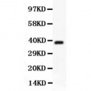 Hamartin  Antibody