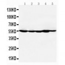 HDAC2 Antibody