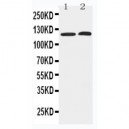 HDAC5 Antibody