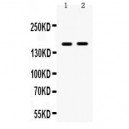 HDAC6  Antibody