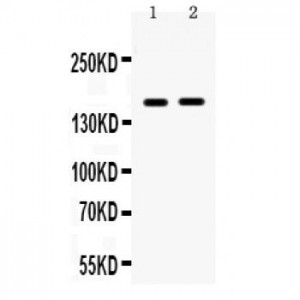 HDAC6  Antibody