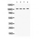 HDAC7  Antibody