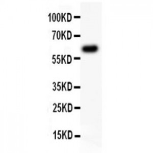 Heparanase 1  Antibody