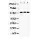 Heparanase 1  Antibody