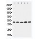 Hepsin Antibody