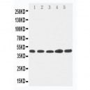 Hepsin Antibody