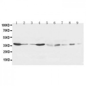 Hex Antibody