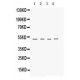 Keratocan  Antibody