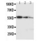 Ki67 Antibody