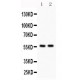 KIAA0652  Antibody