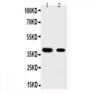 KLF5 Antibody