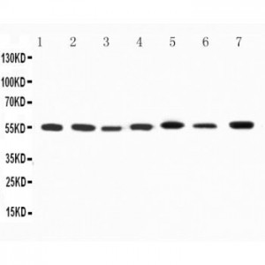 Kv1.1 potassium channel Antibody