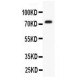 Kv4.3  Antibody