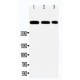 Laminin 2 alpha Antibody