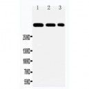 Laminin 2 alpha Antibody