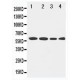 LCAT Antibody