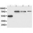 Lipoprotein lipase Antibody