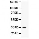 liver Arginase Antibody