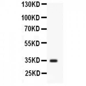 liver Arginase Antibody