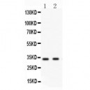 Livin Antibody