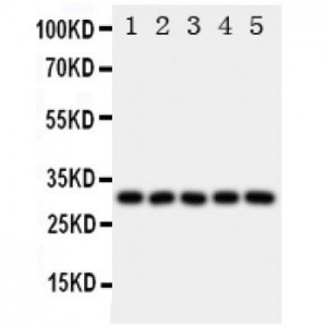 LOX 1 Antibody