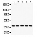 LOX 1 Antibody