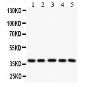 LOX 1 Antibody