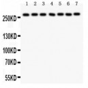 LRRK2  Antibody