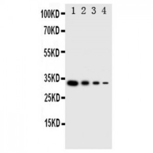 LTK Antibody