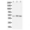 LXR alpha Antibody