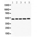 LXR alpha Antibody