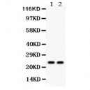 Mad2L1  Antibody