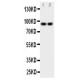 MALT1 Antibody