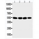 Matrilin 3 Antibody