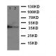 MBD1 Antibody