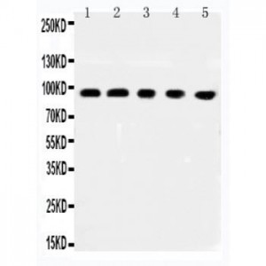 MCC Antibody