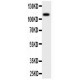 MCSF Receptor Antibody