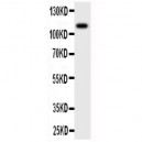 MCSF Receptor Antibody