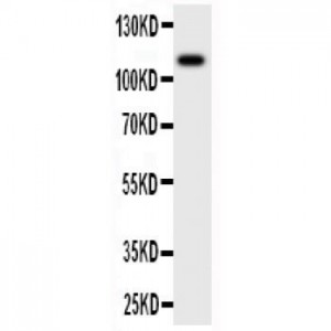 MCSF Receptor Antibody