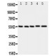 MEF2A Antibody