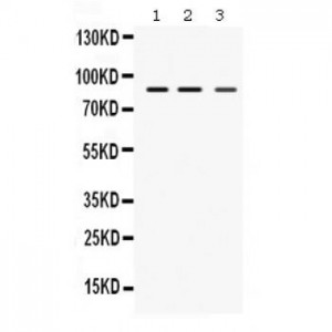 MEFV  Antibody