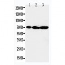 MEKK2 Antibody