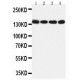 MERTK Antibody